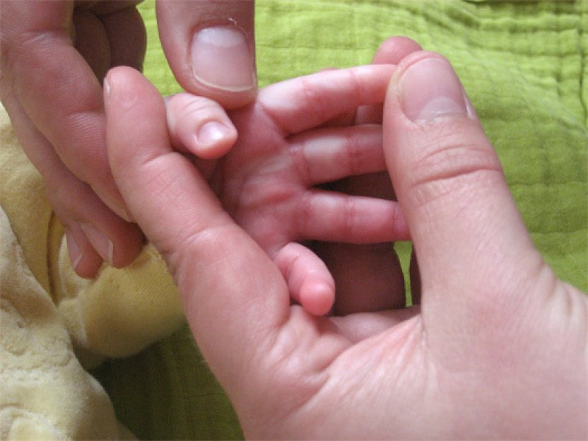 Kindertuina hand 1